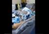 video que mostra idosa viva em saco preto em hospital revolta internautas veja